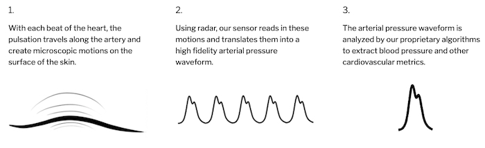 60 GHz CW雷达的血压循环非接触分析。